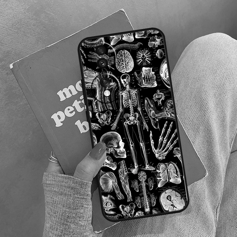 حافظة تشريح الهيكل العظمي الطبي لهاتف Honor Magic 8 7 6 5 Pro Cover For Honor 400 200 X9c X9b X9a X8a X8b 50 70 90 Lite