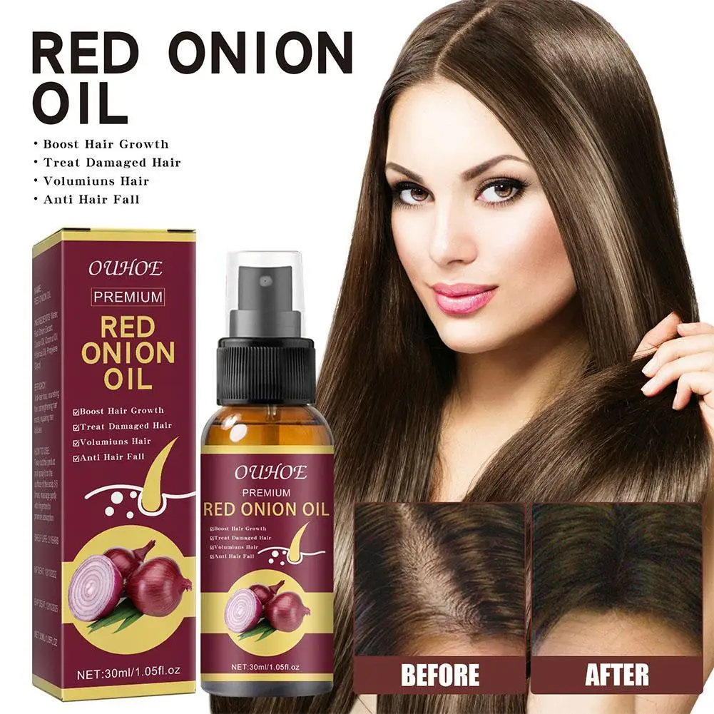 

OUHOE Red Onion Essential Oil Spray Extract Strong Firm And Moisturized Hair For Hair Care And Growth Prevent Hair Loss