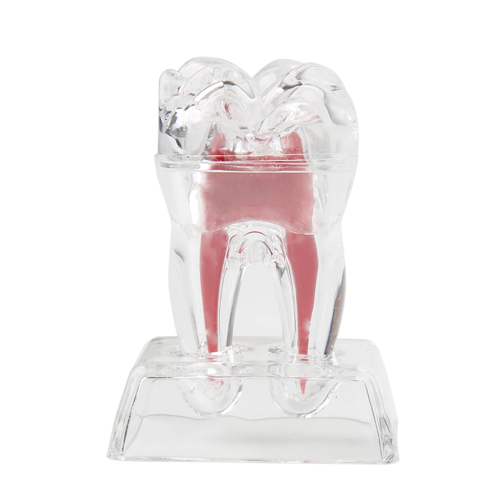 Dental Model Decomposable Dental Model Transparent Dental Teaching Model Transparent Small Ornament