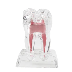 Dental Model Decomposable Dental Model Transparent Dental Teaching Model Transparent Small Ornament