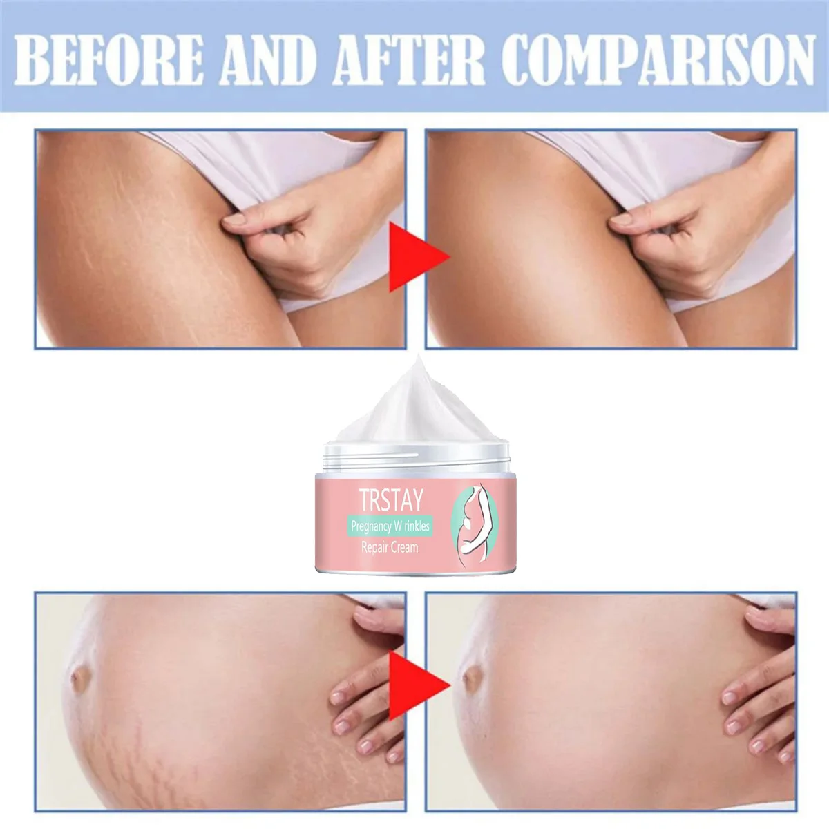 TRSTAY crème réparatrice pour la grossesse soins de la peau élasticité humidité collagène vergetures et cicatrices fondues pendant la maternité