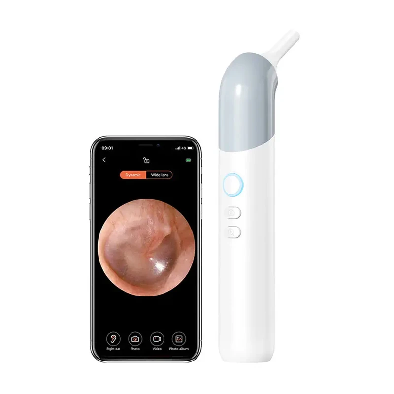 3-in-1 Smart Ear Cleaner with HD Camera - Ear Care Removal Kit & Pet/Dog Ear Cleaning Detector Device
