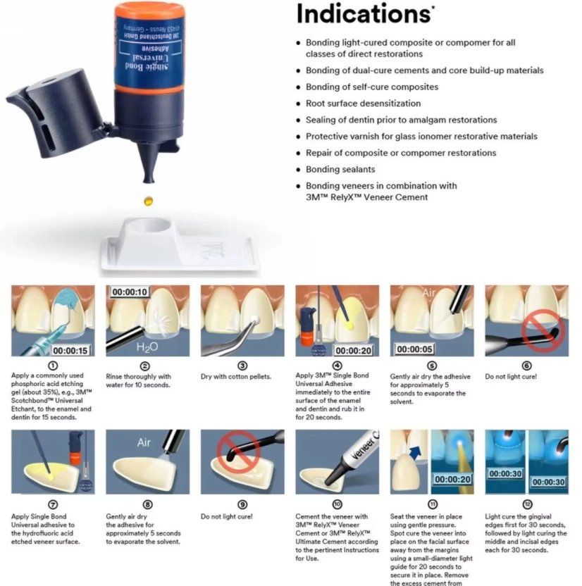 5ML/Bottle   Single Bond Denta Universal Adhesive Light Cure Composite Restorations Resi Bonding Agent Teeth Glue