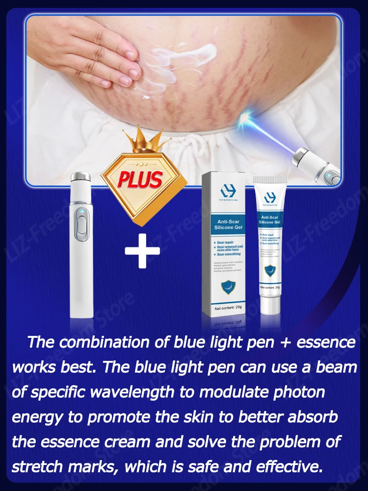 Blu-ray Pen For Pregnancy Stretch Marks Improve