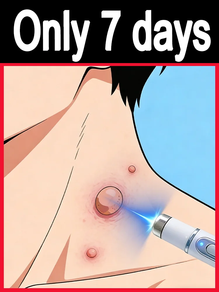 

Say goodbye to the embarrassmentᵃⁿᵈ ᵖᵃⁱⁿ ᶜᵃᵘˢᵉᵈ ᵇʸ ʷᵃʳᵗˢ⸴ ⁿᵒ ⁿᵉᵉᵈ ᵗᵒ ʷᵃⁱᵗ ᵒʳ ᵉⁿᵈᵘʳᵉ ⁱ