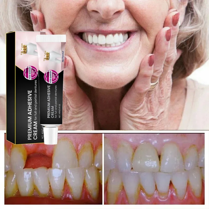 Klej do mocowania protez poprawić komfort zużycia protez zapobiegaj wypuszczaniu się protez klej termoplastyczny klej Falseteeth stały klej