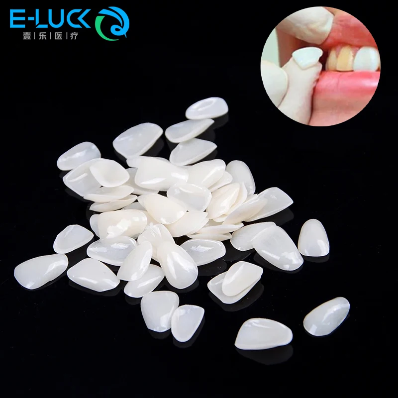 

Dental Teeth Veneers False Temporary Tooth Crown Resin Anterior Upper Porcelain Whitening Teeth Veneers Bright White