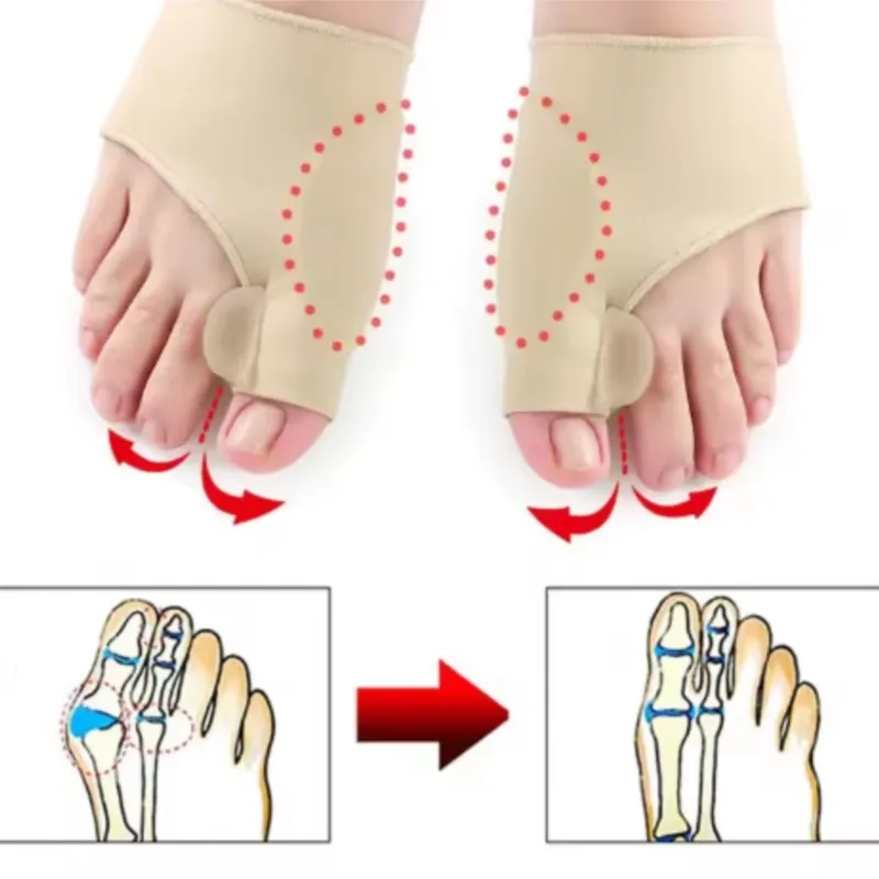 Corrector de dedos ortopédico pies cuidado de los pies hueso pulgar ajustador corrección suave pedicura calcetines juanete enderezador (1 par/2 pares)