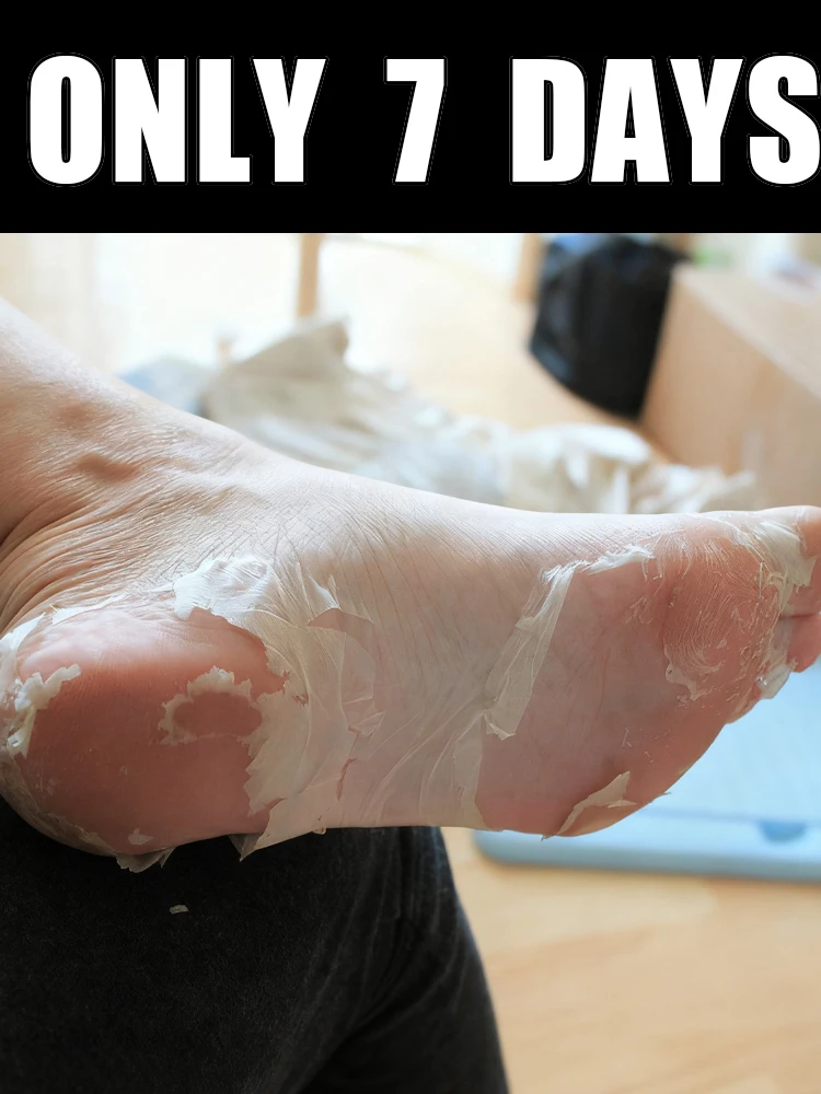 Questo spray per i piedi di 7 giorni è adatto per i piedi dell'atleta, asciutti, ruvidi, screpolati, talloni e calli.