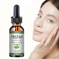 Acne Treatment Face Serum Tea Tree Oil Essence Moisturizing Shrink Pores Acne Facial Serum Korean Skin Care Products