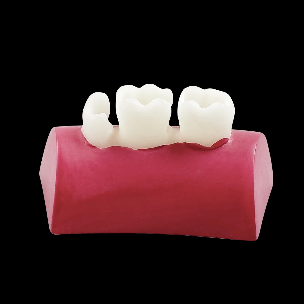 

Набор из 10 моделей зубов для отработки ингредиентирования и пломбирования композитом, учебные модели для тренировки и обучения, типодонты для изучения стоматологических процедур