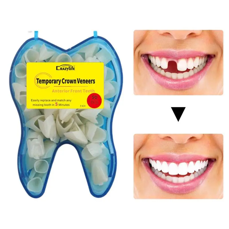 Temp Tooth Replacement Resin Temporary Crowns For Tooth Repair Anterior Crown Temporary ToothDIY Replace A Missing Tooth In