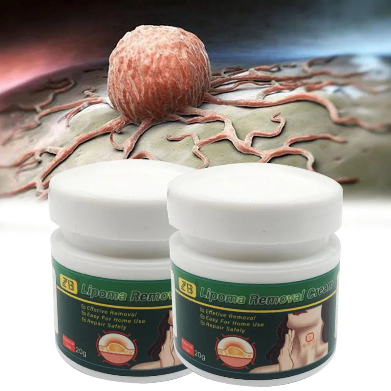 ZB 20g Pure Natural Chinese Herbal Lipoma Removal Cream Efficiently Removes Lipoma Fibroids Subcutaneous Lumps Body Health Care