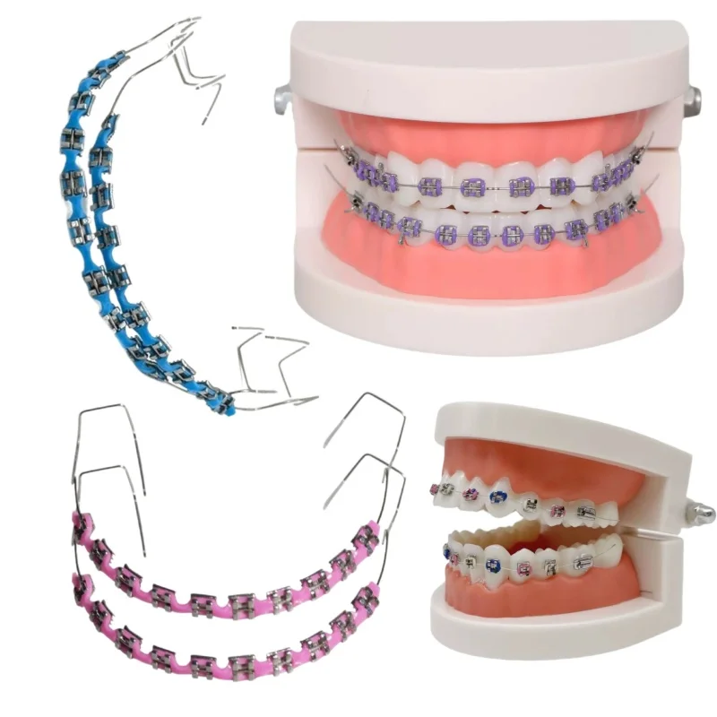1 Pair Dental Decorations Colorful Temporary Tooth Decoration with Metal Wires Fake Brackets Orthodontic Ligature Ties Braces