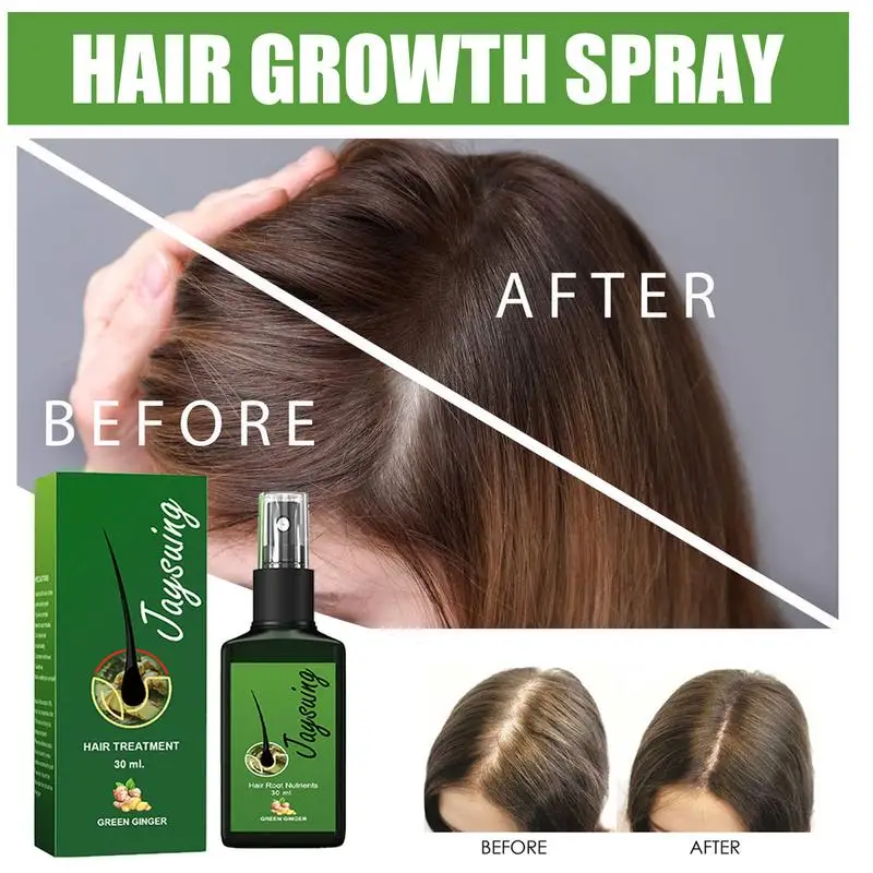 Spray Herbal para crecimiento del cabello Unisex, aceite de jengibre para crecimiento rápido del cabello, 30/120ML