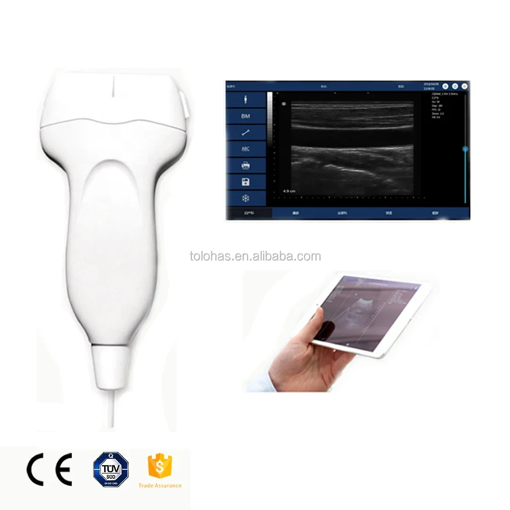 LHUP20L Medical USB Linear Ultrasound Probe /Portable   /Pocket  Machine for Android Windows