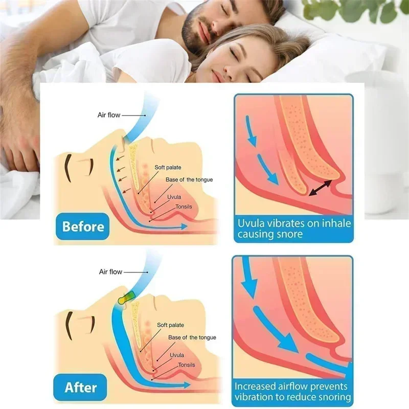 Anti-Snoring Corrector Snore Prevention Gadget Women\'s Anti-Snore Device Snore Elimination Nose Clip Men\'s Sleep Night