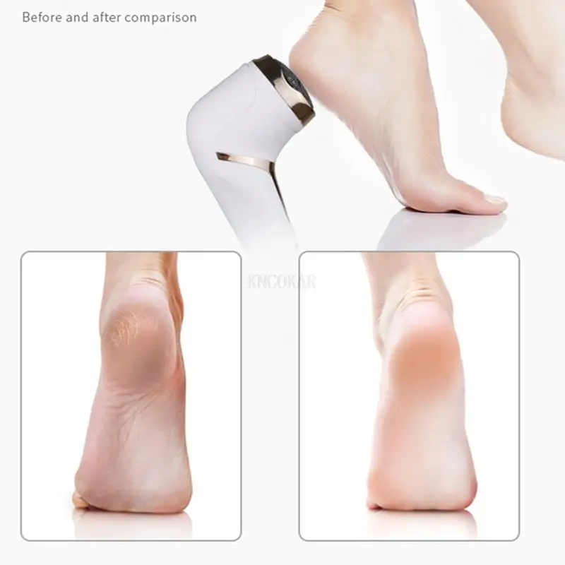 Ferramenta elétrica de pedicure, arquivo de cuidados com os pés, perna, calcanhar para remover calos de pele morta e rachados, remoção de calos de pele morta, lcd, máquina de cuidados de limpeza de pés