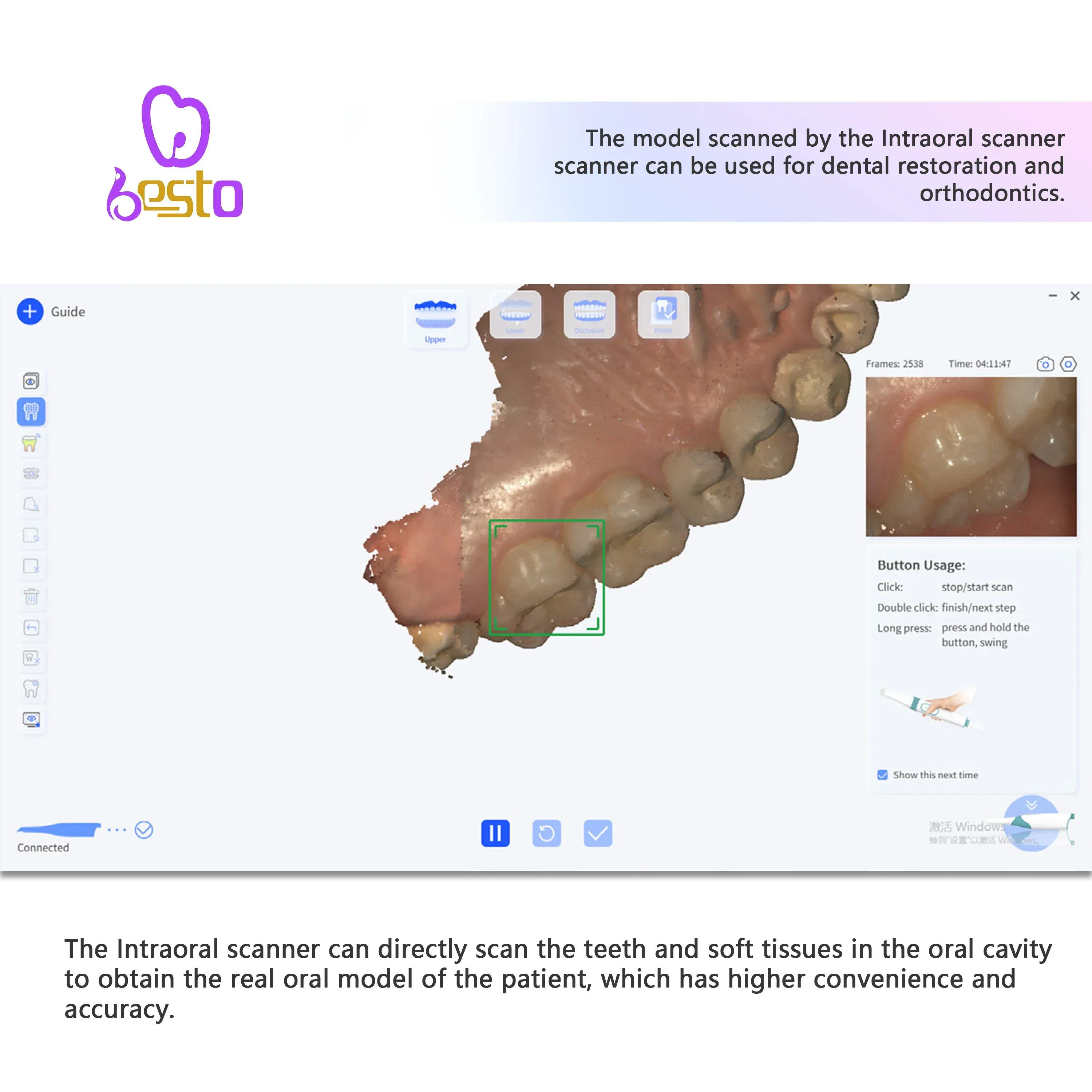 2026 2025Intraoral Scanner 3D For Restoration Orthodontics Crown Equipment