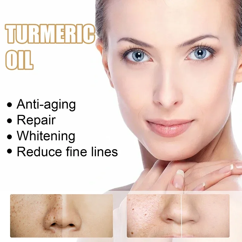 Turmeric Brightening Serum Lightens Dark Spots Fade Face Wrinkles Anti Aging Whitening Essential Oil Face Skin Care 30ml