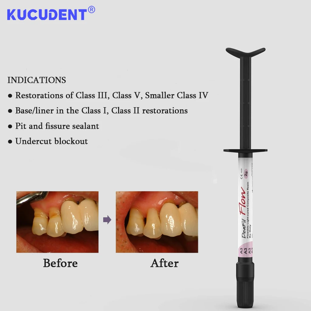 DenFil Flow Resina Composta Fluxível Dental Fotopolimerizável Radiopaca - Relleno Dental Adesão Restauração de Coroa