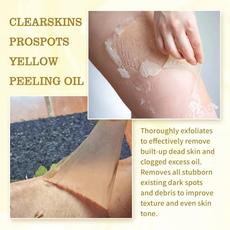 Óleo de peeling amarelo para pele escura, clarear loção, clarear corpo, cotovelo, joelho, mão, esfoliar, pele morta nutrir, mesmo tom de pele, alvejante, forte