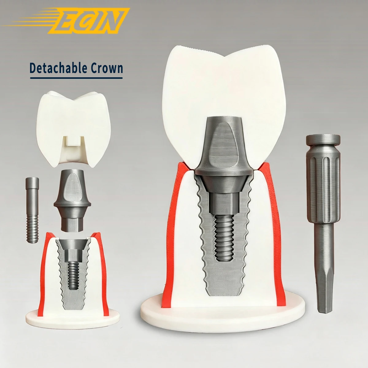 Dental Implant Model Detachable Teeth Teaching Training Practice Model Oral Implant Demo Dentist Patient Communication Education