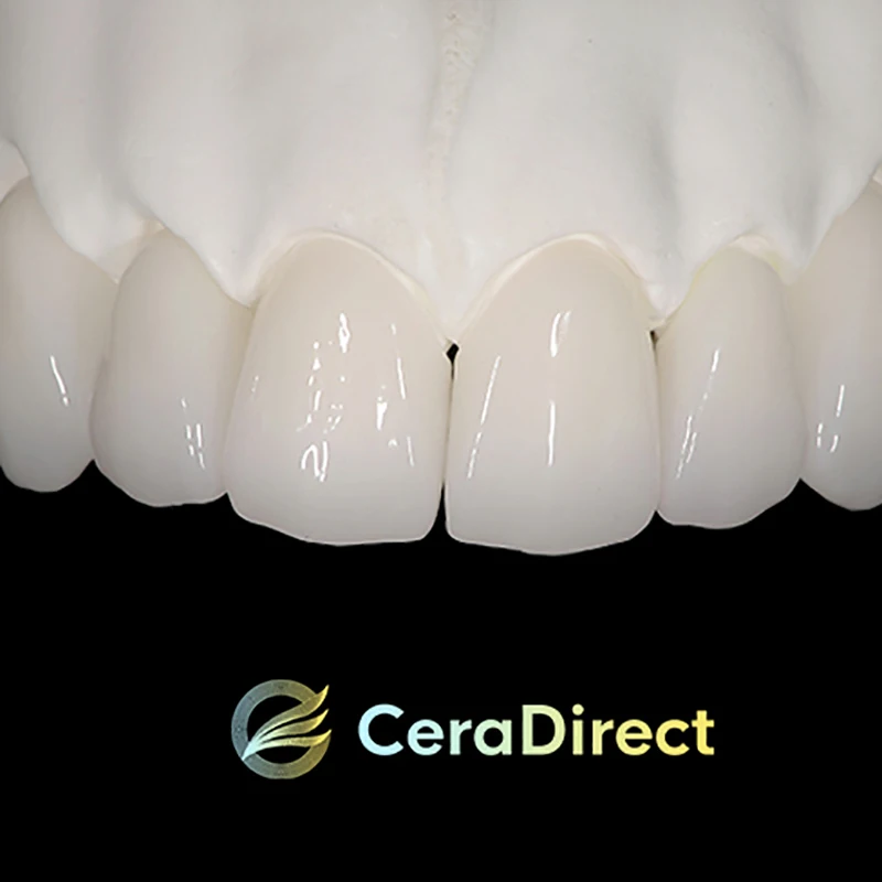 Zirconia Blocks SHTML หลายชั้น 98 มม. ระบบเปิด Ceradirect สําหรับห้องปฏิบัติการทันตกรรม CAD/CAM
