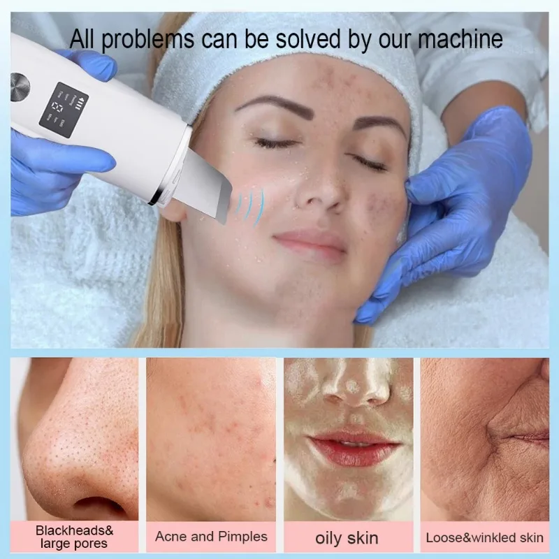 Ultraschall Gesicht Wäscher Gesichts Peeling Haut Wäscher Tiefe Gesichts Reinigung Spachtel Akne Poren Ultraschall Wäscher Gesichts Reiniger