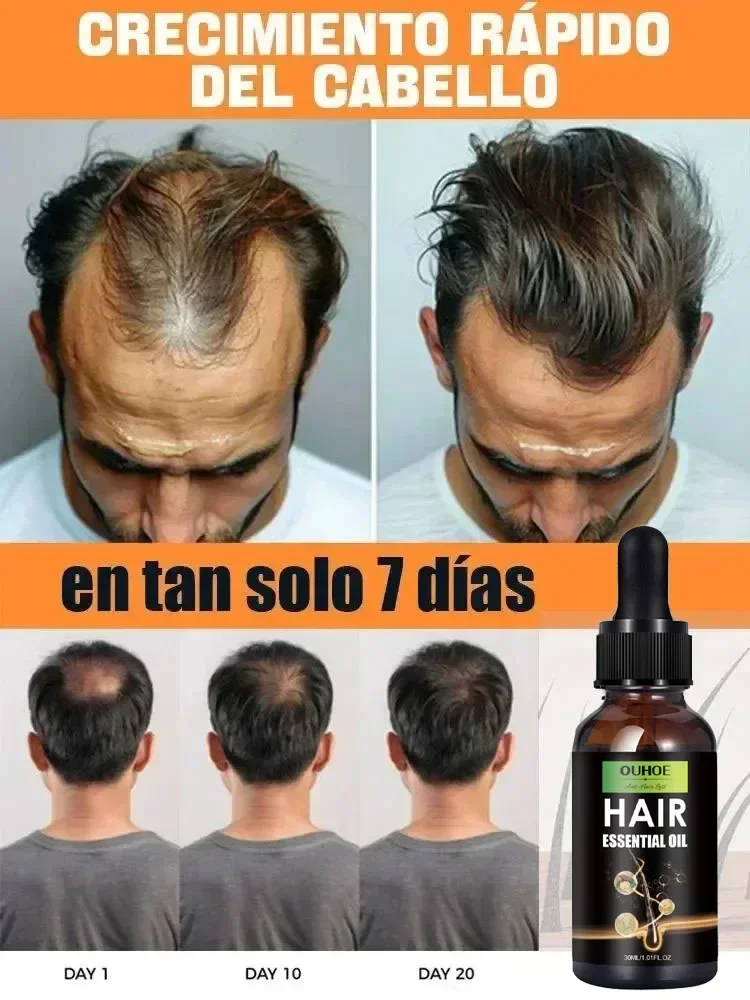 7 Days Fast Hair Growth Serum Anti-loss Hair Regrowth Products Repair Nourish Damaged Hairs Scalp Care Oil For Women Men