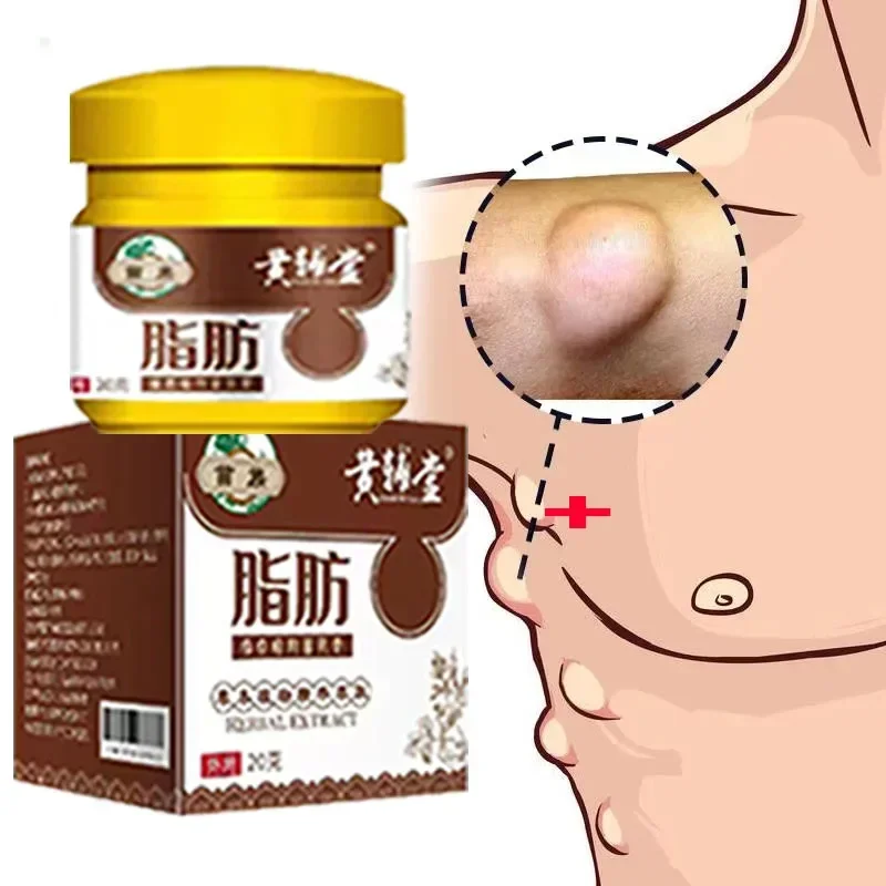 

Lipoma Cream Effective Tightening The Skin Natural Scent Easy To Absorb Non-sensitive Cream Relieve Discomfort
