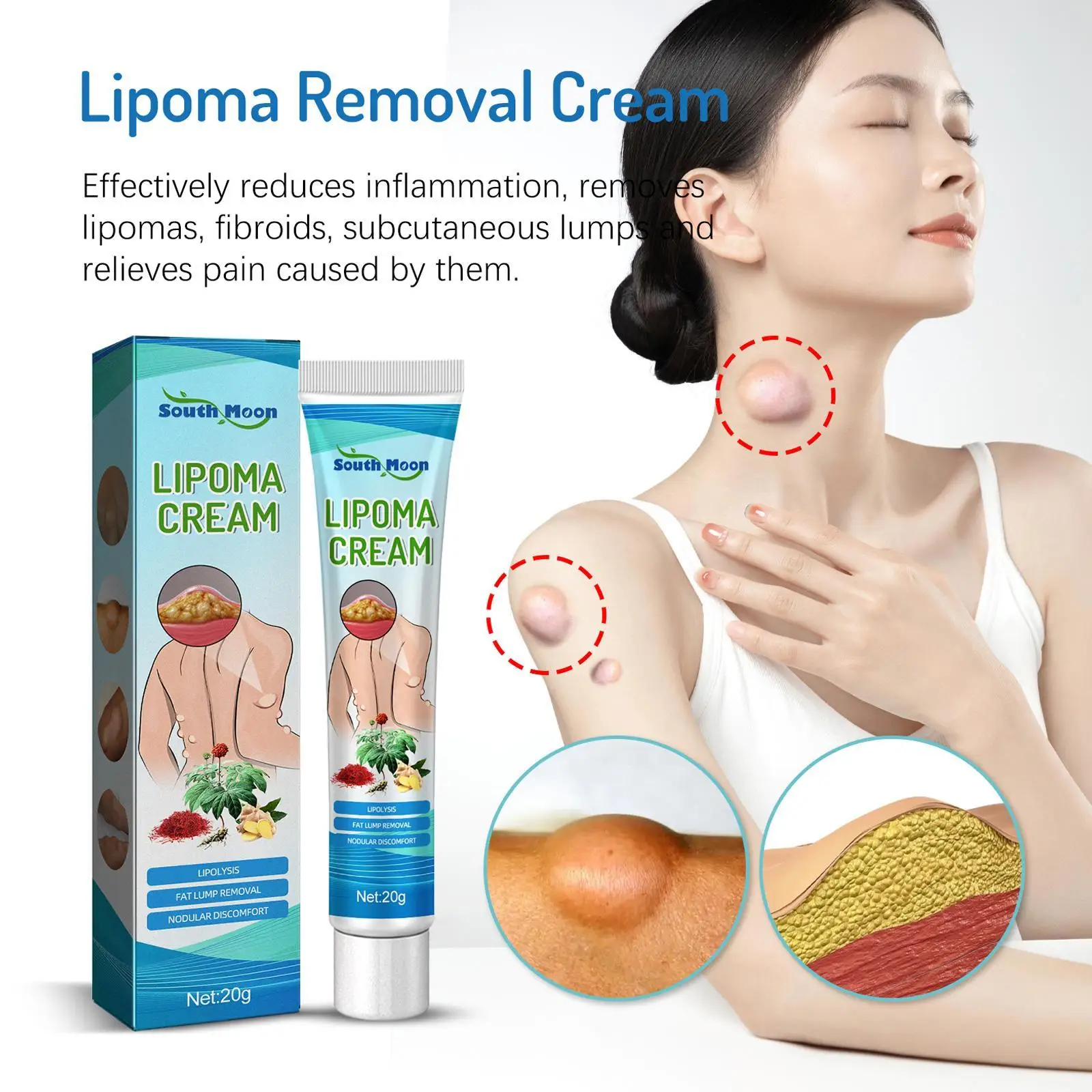 

20g Lipoma Treatment Cream Lipolysis Removal Skin Swelling Cellulite Ointment Tumor Exfoliating Pain Relief Plaster Health Care