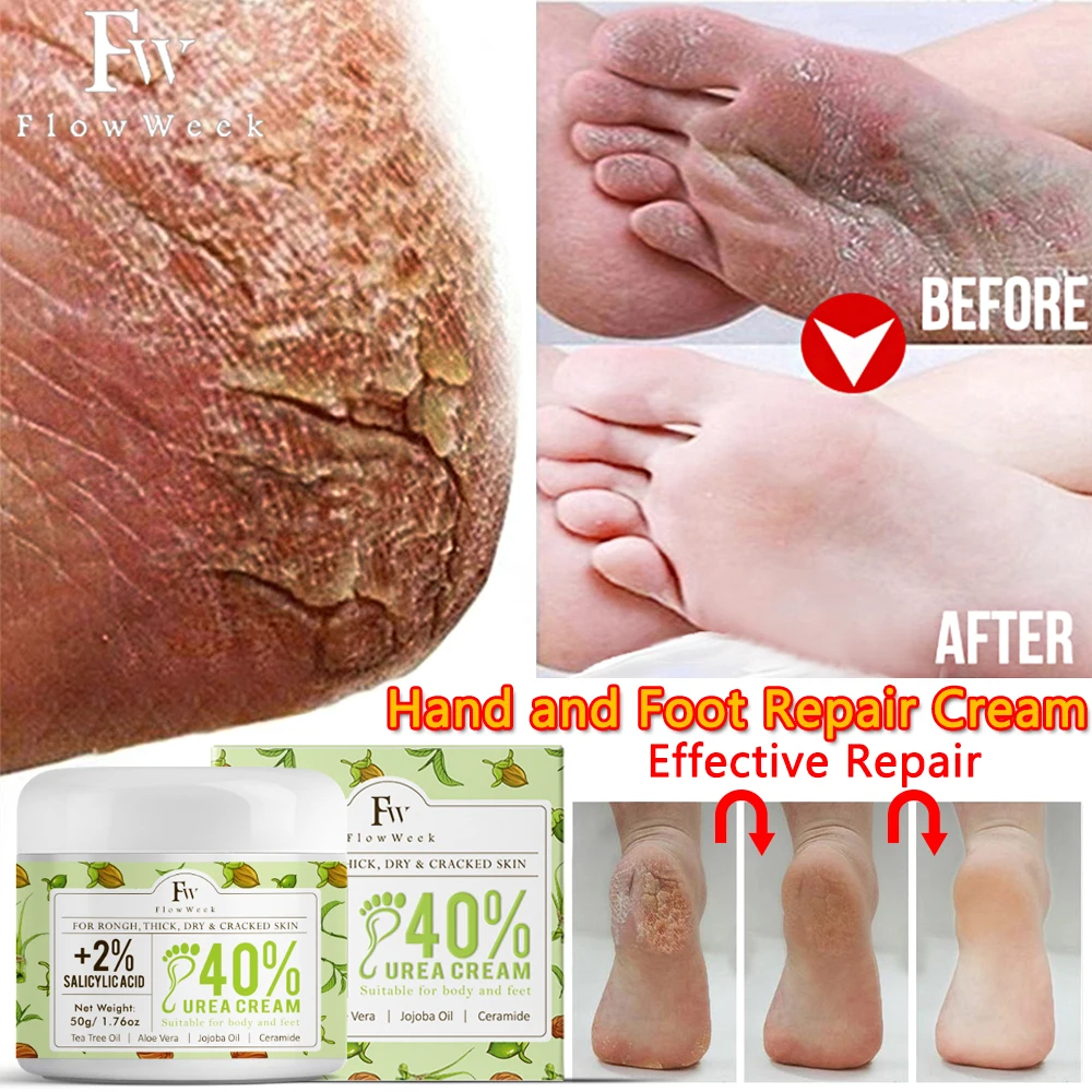 

50g Anti Crack Foot Cream Anti-Drying Heel Cracked Repair Calluses Dead Skin Removal Moisturizing Hand Feet Care Beauty Health