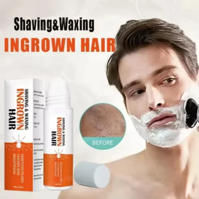 

Razor Bumps Removal Solution Ingrowns Hair treatment Kit After Shave Repair Dark Spot Reduce Redness Serum for vanish PFB Pimple