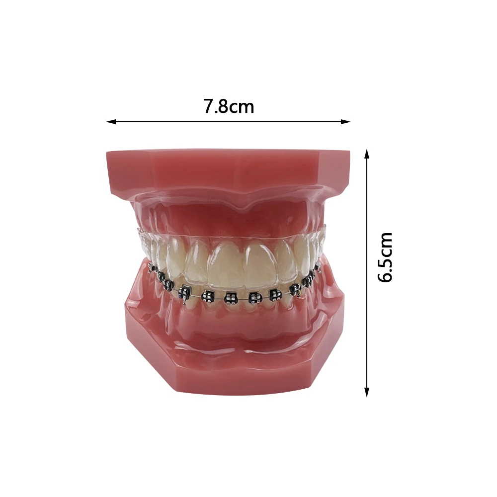 1Pcs Dental Orthodontic Teeth Model With Retainer Invisible Bracket Teaching Model Typodont For Dentistry Training Demonstration