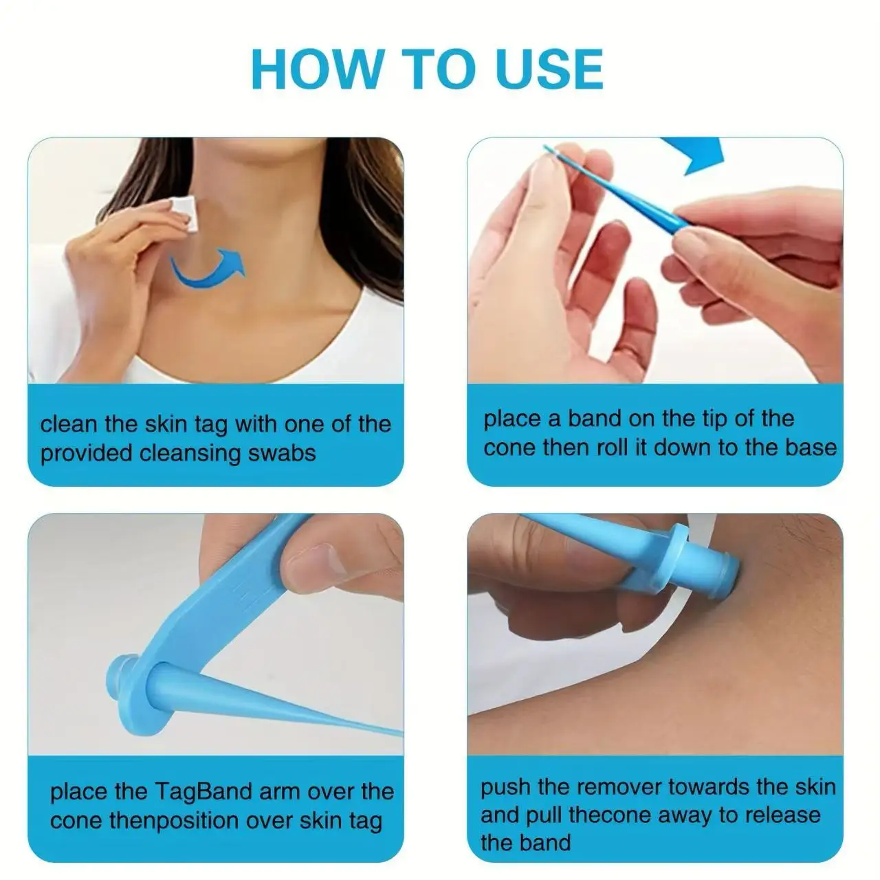 Kit de remoção de verrugas com etiqueta de pele 3 em 1, ferramenta de cuidados de beleza para toupeira automática indolor com cotonetes de limpeza para cuidados de beleza facial