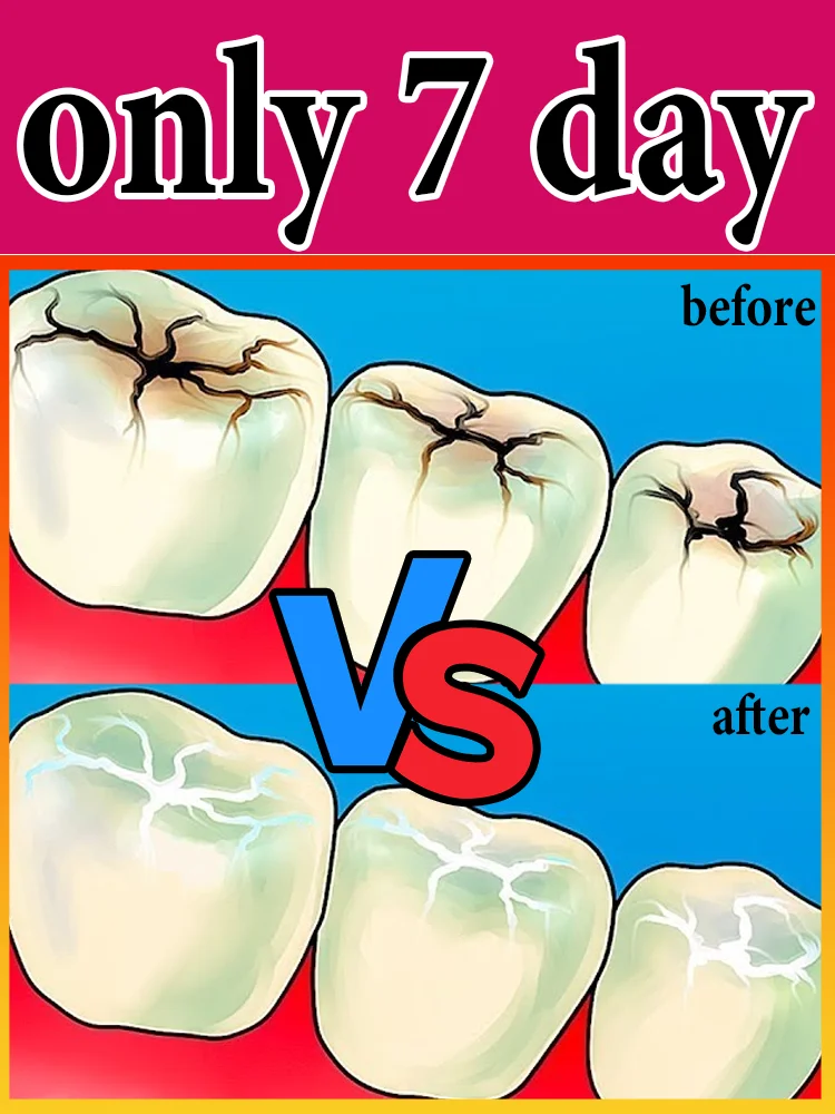 

Sᴄɪᴇɴᴛɪғɪᴄ Rᴇᴘᴀɪʀs Cᴀᴠɪᴛɪᴇs, Cʟᴇᴀɴs Pʟᴀᴏ̨ᴜᴇ, Wʜɪᴛᴇɴs Tᴇᴇᴛʜ