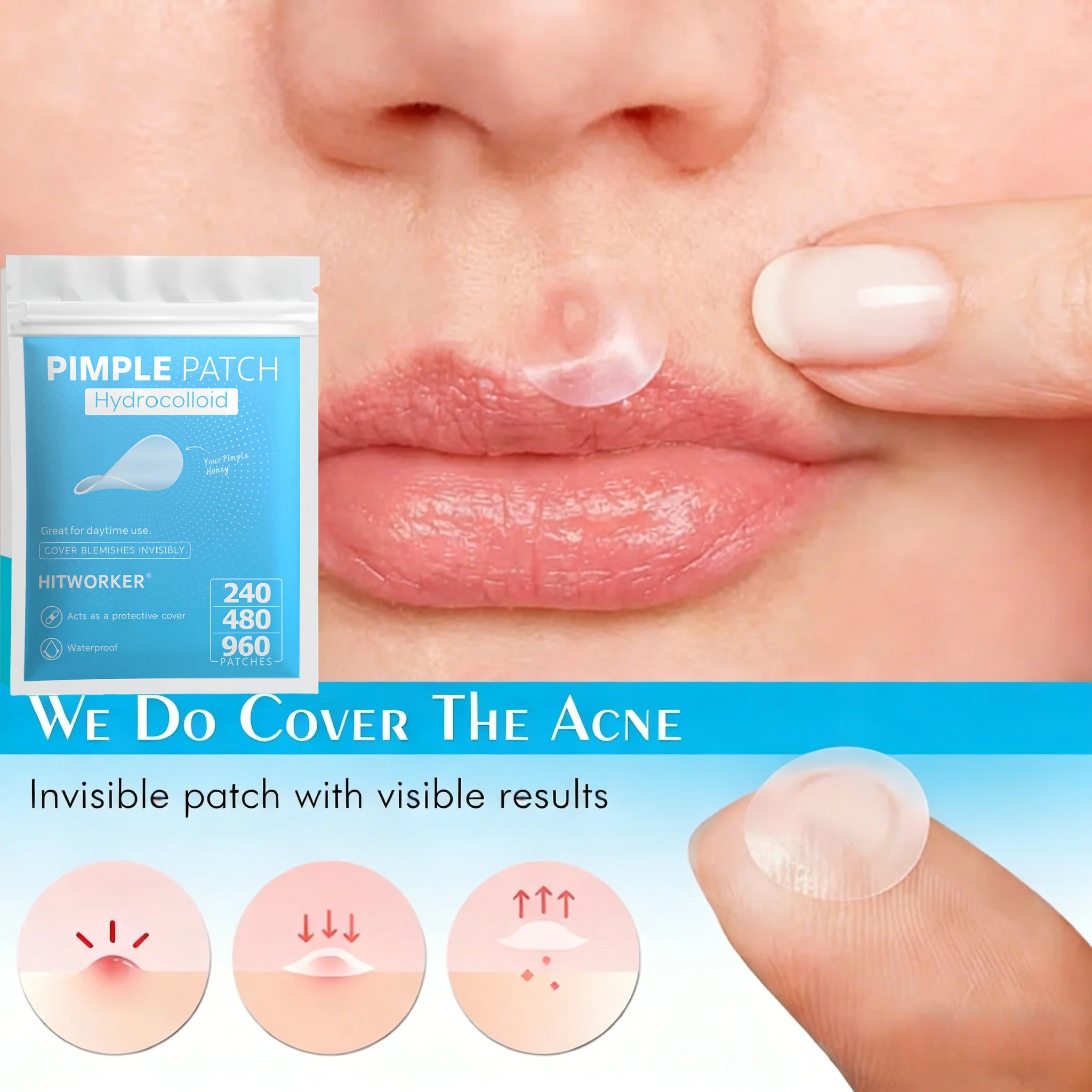 240/480/960pcs Hydrocolloid Acne Patches, Effective Pimple Treatment, Invisible Blemish Cover for Face Skin