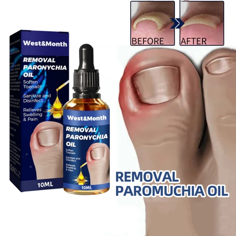 Removal Paronychia Oil Relieves Swelling Pain Putty Nail Repair Softener Trim with Ease Oil Liquid Toenail Treatment Feet  Care