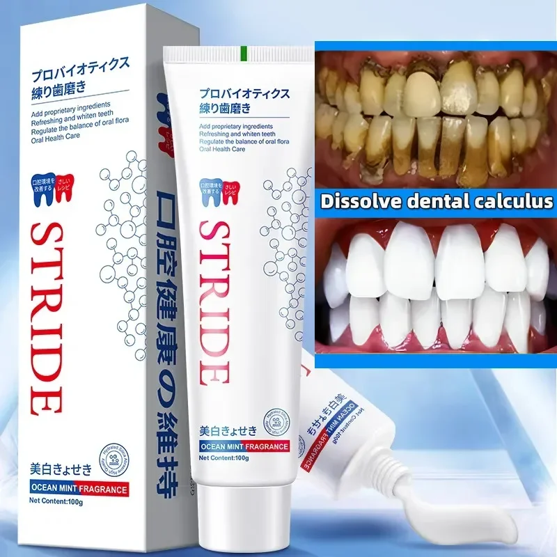 Removedor de cálculo Dental, eliminación de mal aliento, blanqueamiento Dental, pasta de dientes, prevención de la Periodontitis, cuidado de limpieza Dental