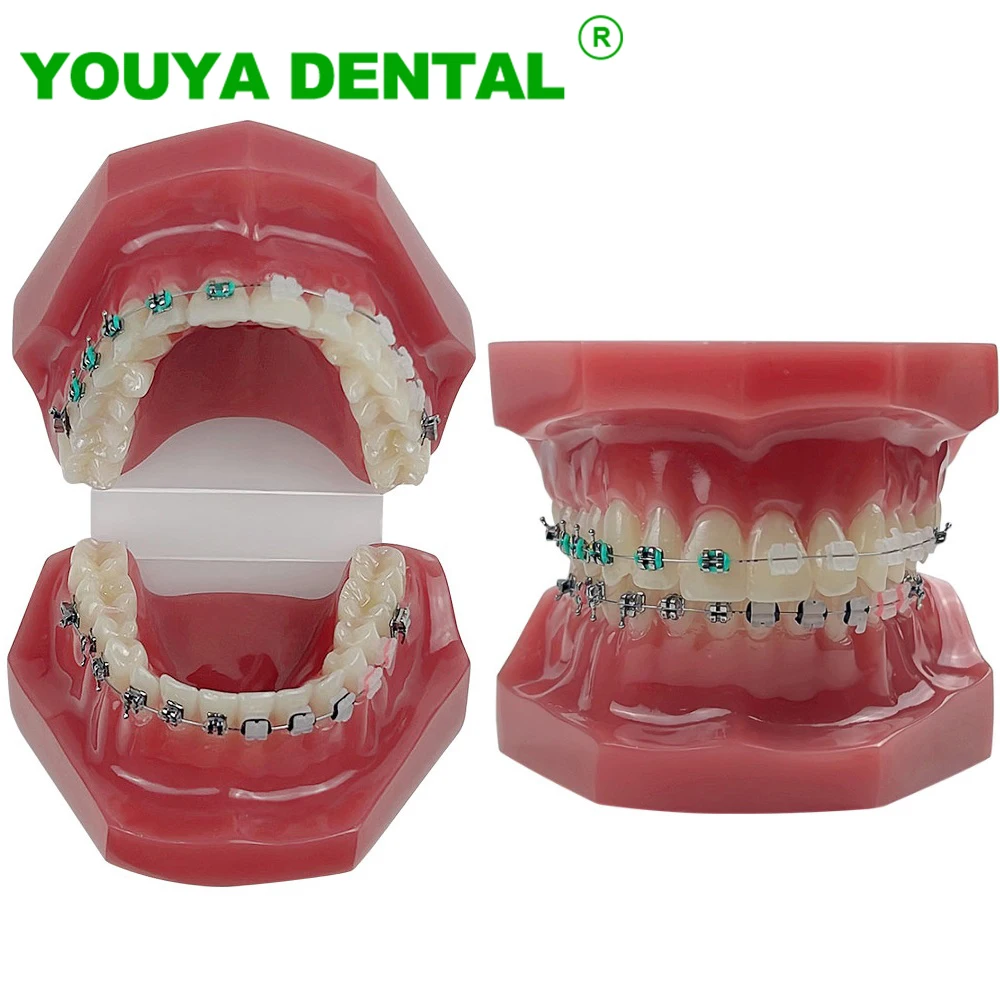 Dental Orthodontic Teeth Study Model With Metal Ceramic Bracket Braces Dentistry Teaching Training Practice Demonstration Tools