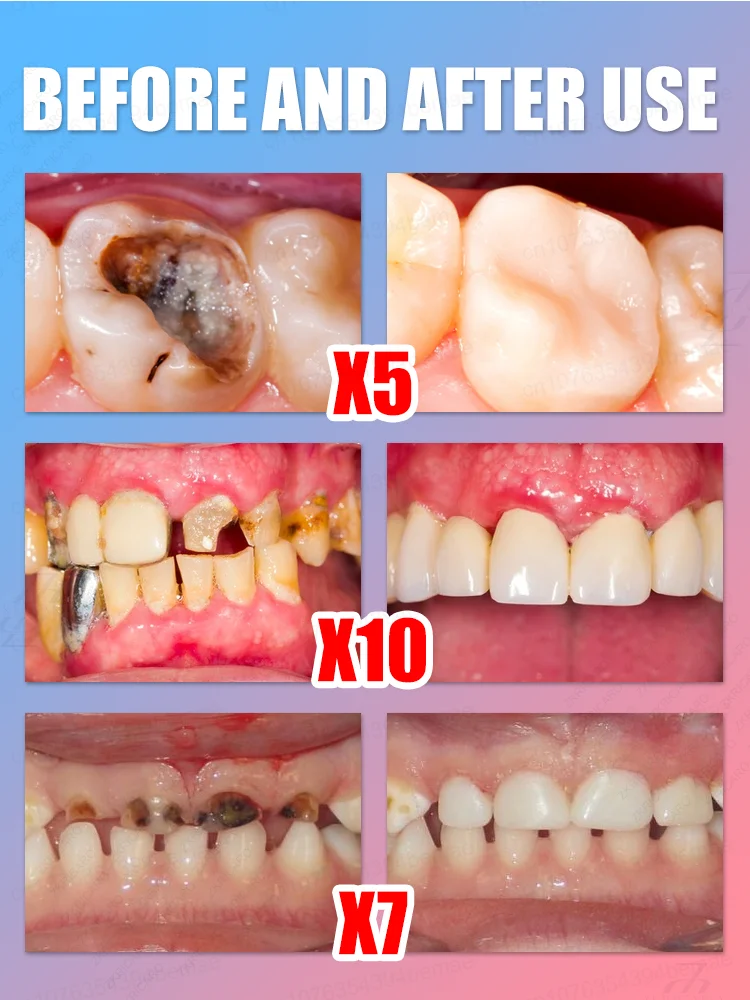 

Teeth Whitening Toothpaste - Enzyme Formula, Stain Removal, Deep Cleaning, Fresh Breath, Free Shipping