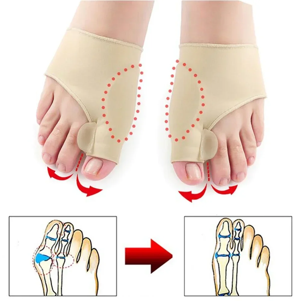 1 par separador de dedo do pé hálux valgus joanete corrector martelo alisador de dedo do pé alívio da dor ortopédica ferramentas pedicure cuidados com os pés
