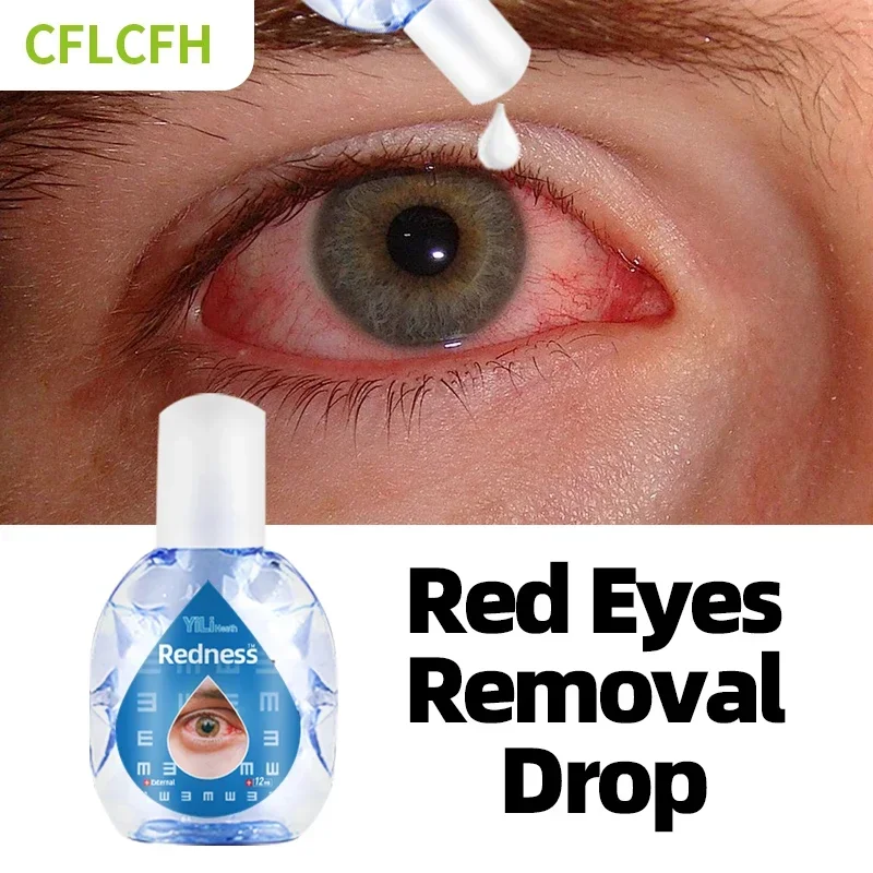 

Red Eyes Removal Treatment Eye Drop Eye Discomfort Visual Fatigue Dry Eyes Pain Excessive Eye Use Protect Vision Care Drops 12Ml