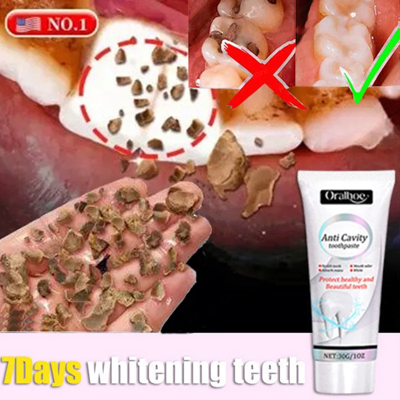 

Repair Tooth Decay Toothpaste Remove Plaque Relieve Periodontitis Toothache Freshen Whiten Teeth Bad Breath Useful Oral Care