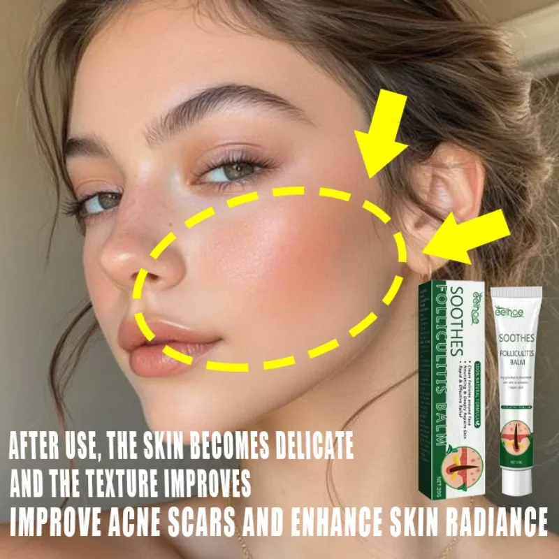 

Anti acne Cream Treatment of Acne Marked Skin Care Whitening&Acne Removing face cream Smooth&Whitening face cream