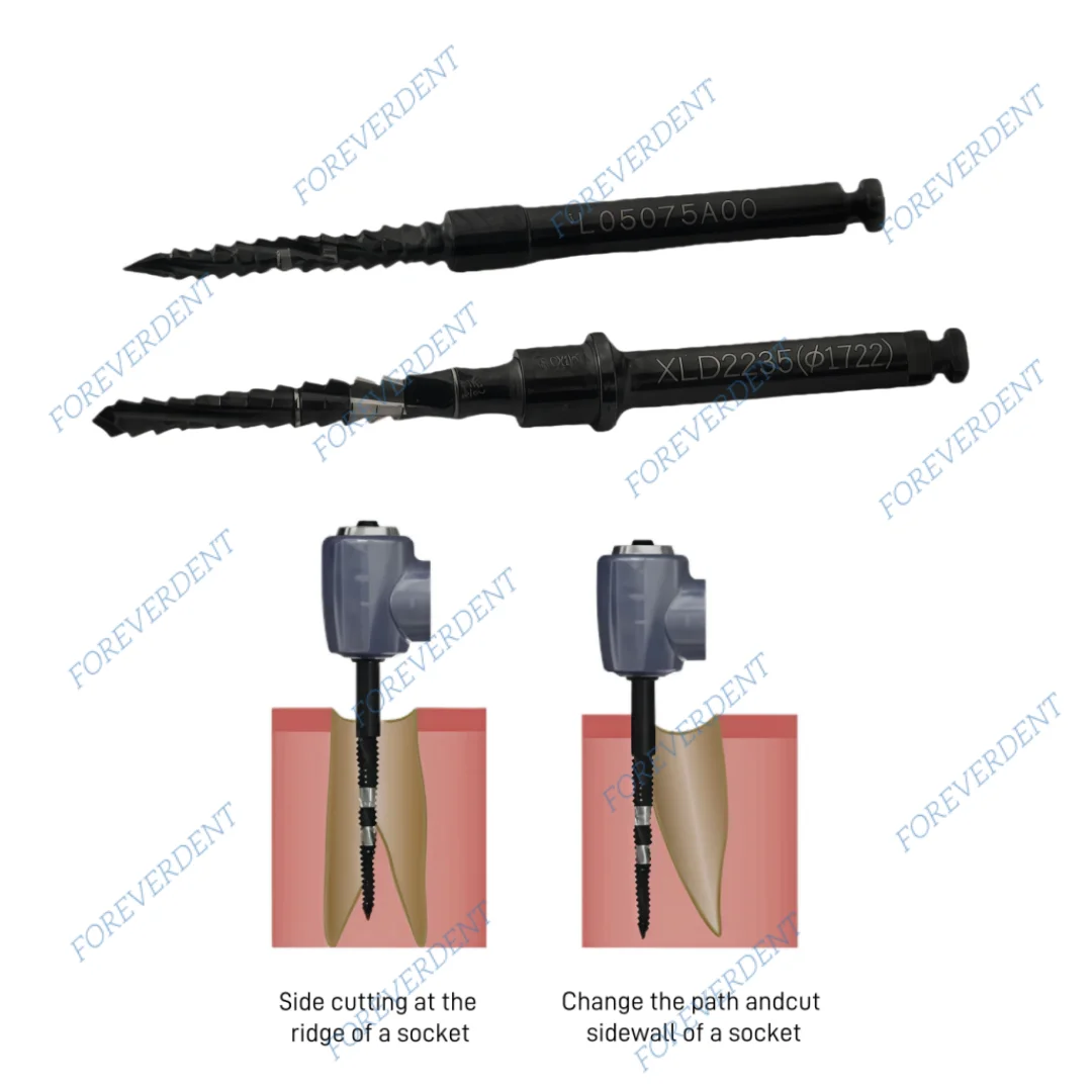 Dental Cross Cutter Bone Side Cut Drill Implant Graft Bit Dentist Clinic Lab Black φ2.0mm/φ2.2mm
