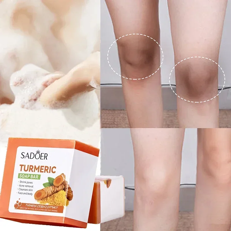 Turmeric Skin Whitening Soap  Lighten Dark Underarm Leg Remove Dead Skin Lightening Brightening Face Glowing Skin Hand Soap