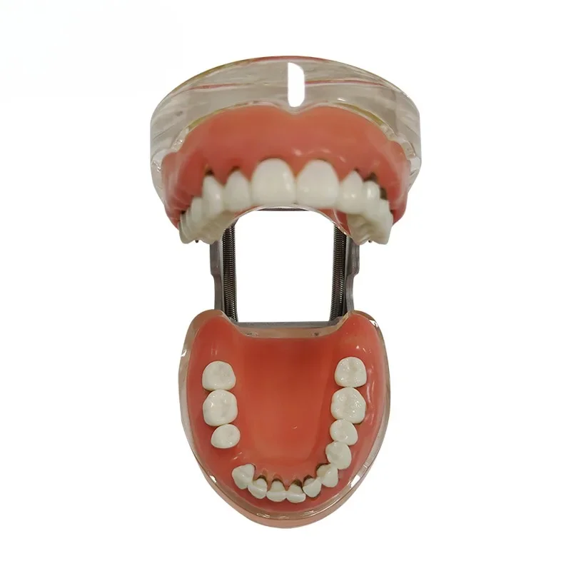 Pathology periodontal gingival disease model teaching