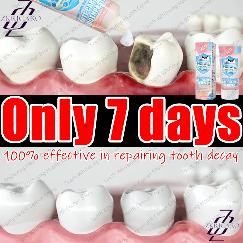 

Эффективно удаляет и восстанавливает карниз и защищает зубы.